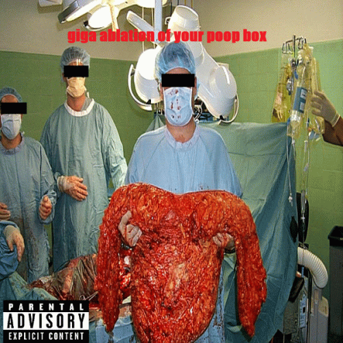 Megacoloncancer : Giga Ablation of Your Poop Box